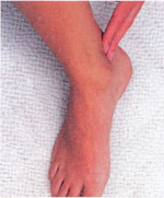 Массаж ног укрепляющий иммунитет thumbnail