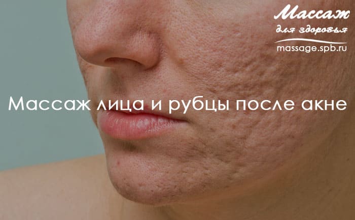 массаж лица и прыщи
